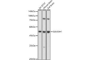 Western blot analysis of extracts of various cell lines, using SUV39H1 antibody (ABIN6128786, ABIN6148747, ABIN6148748 and ABIN6220187) at 1:1000 dilution. (SUV39H1 anticorps  (AA 1-220))