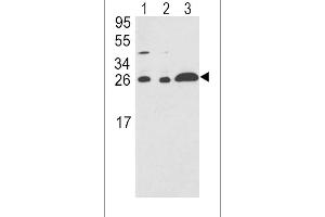 Western blot analysis of ARHGDIA Antibody (C-term) (ABIN389429 and ABIN2839511) in (lane 1),HL-60(lane 2),Ramos(lane 3) cell line lysates (35 μg/lane).