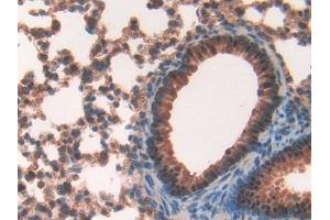 DAB staining on IHC-P; Samples: Mouse Lung Tissue