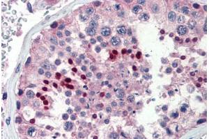 Human Testis (formalin-fixed, paraffin-embedded) stained with NR0B1 antibody ABIN462167 followed by biotinylated goat anti-rabbit IgG secondary antibody ABIN481713, alkaline phosphatase-streptavidin and chromogen.