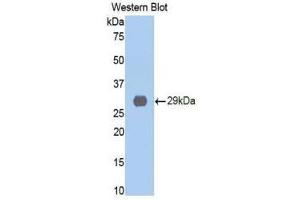 Western Blotting (WB) image for anti-Cathepsin D (CTSD) (AA 169-408) antibody (ABIN1858545) (Cathepsin D anticorps  (AA 169-408))