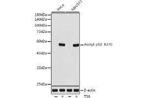Western blot analysis of extracts of various cell lines, using Acetyl-p53- K370 antibody (ABIN7271082) at 1:1000 dilution.