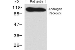 Image no. 1 for anti-Androgen Receptor (AR) (AA 648-652) antibody (ABIN401550) (Androgen Receptor anticorps  (AA 648-652))