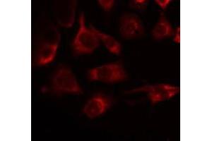ABIN6275234 staining Hela by IF/ICC. (MRPS22 anticorps  (C-Term))