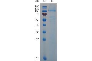 Mouse VWF (23-763) Protein, His Tag on SDS-PAGE under reducing condition.