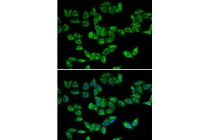Immunofluorescence analysis of U2OS cells using PRDX5 antibody. (Peroxiredoxin 5 anticorps  (AA 53-214))