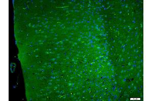 Paraformaldehyde-fixed, paraffin embedded Mouse brain, Antigen retrieval by boiling in sodium citrate buffer (pH6. (DLGAP4 anticorps  (AA 261-370))