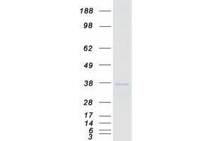 Validation with Western Blot