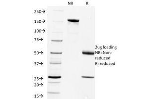SDS-PAGE Analysis of Purified, BSA-Free Rabies Virus Antibody (clone Rab-50). (Rabies Virus anticorps)