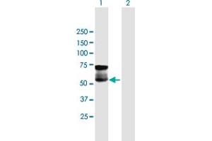 Western Blot analysis of GGT1 expression in transfected 293T cell line by GGT1 MaxPab polyclonal antibody. (GGT1 anticorps  (AA 1-569))