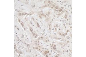 anti-Protein Phosphatase 3, Catalytic Subunit, alpha Isoform (PPP3CA) (C-Term) antibody