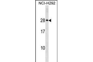HLA-DQA2 Antibody (Center) (ABIN1881421 and ABIN2839048) western blot analysis in NCI- cell line lysates (35 μg/lane).