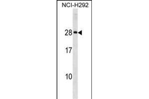 HLA-DQA2 Antibody (Center) (ABIN1881421 and ABIN2839048) western blot analysis in NCI- cell line lysates (35 μg/lane). (HLA-DQA2 anticorps  (AA 39-66))