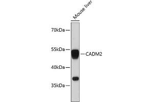 Western blot analysis of extracts of mouse liver, using C antibody (ABIN6129649, ABIN6137839, ABIN6137840 and ABIN6215420) at 1:3000 dilution. (CADM2 anticorps  (AA 220-335))
