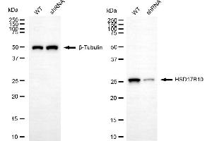 anti-Hydroxysteroid (17-Beta) Dehydrogenase 10 (HSD17B10) antibody