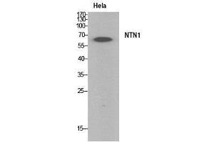 Western Blot (WB) analysis of HeLa cells using Netrin-1 Polyclonal Antibody. (Netrin 1 anticorps  (Internal Region))