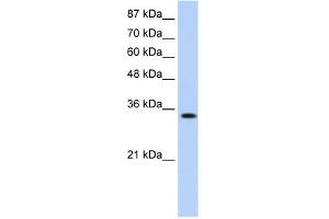 WB Suggested Anti-MBNL1 Antibody Titration:  0. (MBNL1 anticorps  (Middle Region))