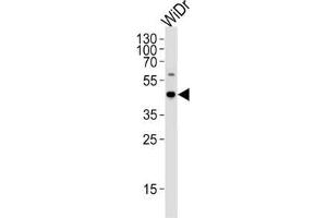 Western Blotting (WB) image for anti-Chromosome 9 Open Reading Frame 72 (C9ORF72) antibody (ABIN2997029)