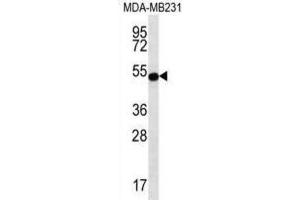 Western Blotting (WB) image for anti-Signal Transducing Adaptor Family Member 2 (STAP2) antibody (ABIN2996919) (STAP2 anticorps)