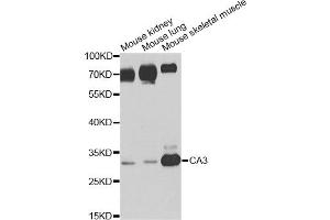 Western blot analysis of extracts of various cell lines, using CA3 antibody. (CA3 anticorps)