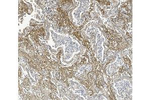IHC analysis of ITGB5 using anti-ITGB5 antibody (ABIN7601320).