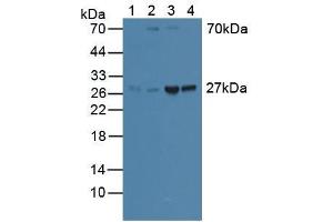 Figure. (GAMT anticorps  (AA 64-236))