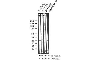 Western blot analysis of Phospho-14-3-3 zeta (Ser58) expression in various lysates