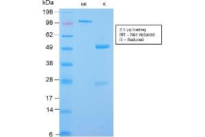 SDS-PAGE Analysis Purified Desmin Rabbit Recombinant Monoclonal Antibody (DES/2960R).