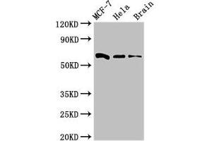 Western Blot Positive WB detected in: MCF-7 whole cell lysate, Hela whole cell lysate, Mouse brain tissue All lanes: SGO1 antibody at 3 μg/mL Secondary Goat polyclonal to rabbit IgG at 1/50000 dilution Predicted band size: 65, 36, 34, 32, 30, 61, 25 kDa Observed band size: 65 kDa (Shugoshin anticorps  (AA 260-439))