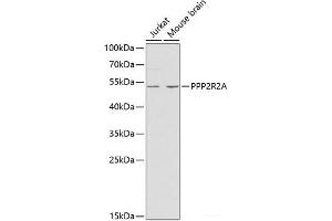 Western blot analysis of extracts of various cell lines using PPP2R2A Polyclonal Antibody at dilution of 1:1000.
