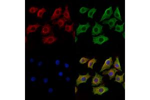ABIN6259765 and ABIN6269299 staining HepG2 cells by IF/ICC.
