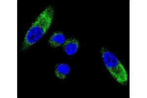 Confocal immunofluorescent analysis of CYP1A1 antibody with MDA-MB231 cells followed by Alexa Fluor 488-conjugated goat anti-rabbit lgG (green).
