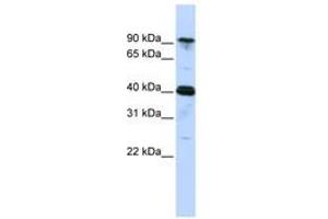 Image no. 1 for anti-Cysteinyl-tRNA Synthetase (CARS) (AA 756-805) antibody (ABIN6740660) (CARS anticorps  (AA 756-805))