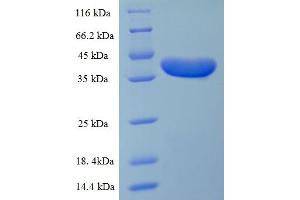 SDS-PAGE (SDS) image for Desmoplakin (DSP) (AA 78-300), (partial) protein (His-SUMO Tag) (ABIN5709423)
