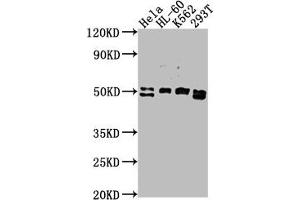 Western Blot Positive WB detected in: HeLa whole cell lysate, HL-60 whole cell lysate, K562 whole cell lysate, 293T whole cell lysate All lanes: DDX47 antibody at 1:2000 Secondary Goat polyclonal to rabbit IgG at 1/50000 dilution Predicted band size: 51, 46 kDa Observed band size: 51 kDa