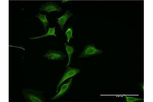 Immunofluorescence of monoclonal antibody to DKK1 on HeLa cell. (DKK1 anticorps  (AA 171-266))
