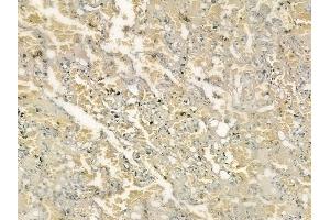 ABIN6261422 and ABIN6276611 at 1/100 staining human normal lung tissue by IHC-P.