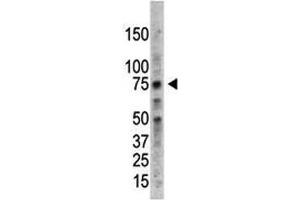 PRMT5 antibody used in western blot to detect PRMT5 in HL-60 cell lysate (PRMT5 anticorps  (AA 591-621))