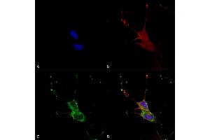 Immunocytochemistry/Immunofluorescence analysis using Mouse Anti-LGI1 Monoclonal Antibody, Clone S283-7 (ABIN1741285).