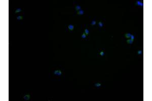 Immunofluorescence staining of PC3 cells with ABIN7167626 at 1:100, counter-stained with DAPI.