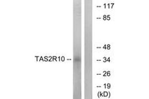 Western blot analysis of extracts from LOVO cells, using TAS2R10 Antibody. (TAS2R10 anticorps  (AA 122-171))