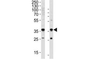 Western blot analysis of lysate from HeLa, HUVEC cell line (left to right) using anti-GAPDH antibody diluted at 1:1000 for each lane.