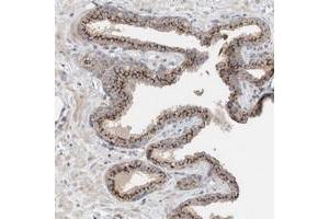 Immunohistochemical staining of human prostate with SLC38A10 polyclonal antibody  shows strong cytoplasmic positivity with a granular pattern in glandular cells at 1:50-1:200 dilution. (SLC38A10 anticorps)