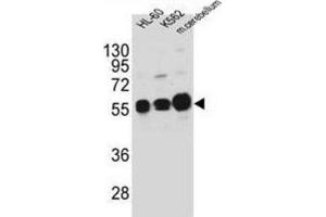 Western Blotting (WB) image for anti-Calcium/calmodulin-Dependent Protein Kinase IG (CAMK1G) antibody (ABIN3003081) (CAMK1G anticorps)