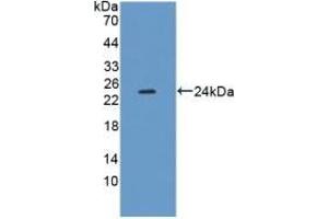 Detection of Recombinant XDH, Mouse using Polyclonal Antibody to Xanthine Dehydrogenase (XDH) (XDH anticorps  (AA 231-416))