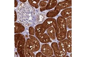 Immunohistochemical staining of human kidney with C11orf54 polyclonal antibody  shows strong cytoplasmic and nuclear positivity in cells in tubules. (C11orf54 anticorps)