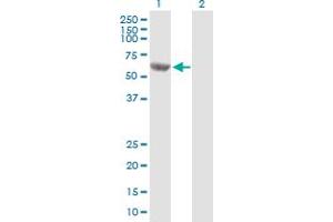 Western Blot analysis of MCCC2 expression in transfected 293T cell line by MCCC2 MaxPab polyclonal antibody. (MCCC2 anticorps  (AA 1-563))