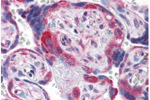 Human Placenta (formalin-fixed, paraffin-embedded) stained with PDGFRA antibody ABIN337400 at 5 ug/ml followed by biotinylated goat anti-rabbit IgG secondary antibody ABIN481713, alkaline phosphatase-streptavidin and chromogen. (PDGFRA anticorps  (C-Term))