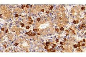 Detection of FSHb in Porcine Pituitary Tissue using Polyclonal Antibody to Follicle Stimulating Hormone Beta (FSHb)