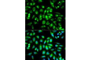 Immunofluorescence analysis of MCF7 cell using CHRM2 antibody. (Muscarinic Acetylcholine Receptor M2 anticorps  (AA 208-388))